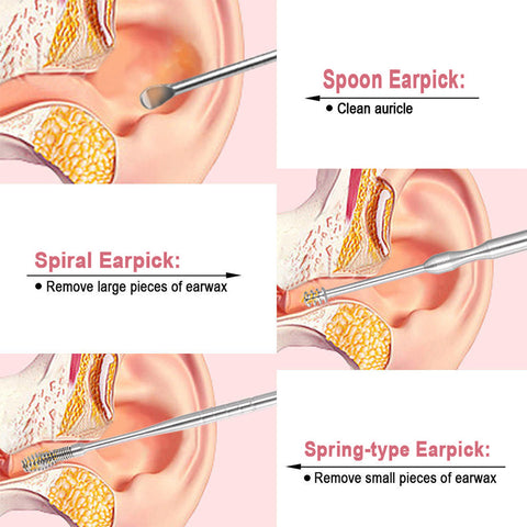 AudiClean™ Ear Cleaning Set